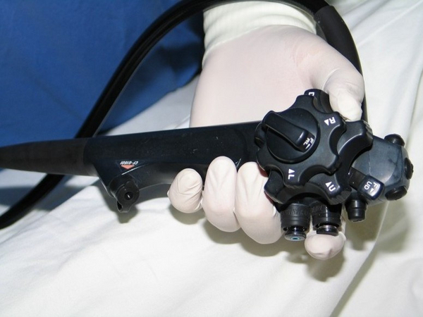 Endoskop wird von Hand gehalten - Diagnostik - Innere Medizin - Albertinen Krankenhaus in Hamburg